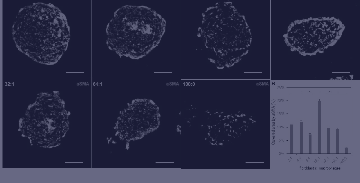 spheroid-article